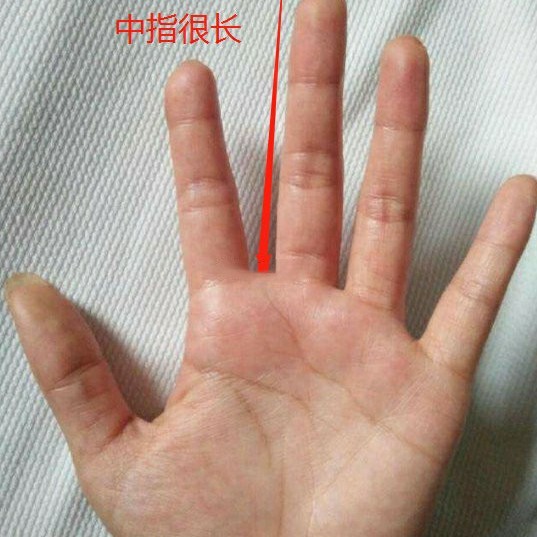 女人左手中指第二关节长痣_女人左手中指和无名指都戴戒指是什么意思?_女人左手中指背面长痣
